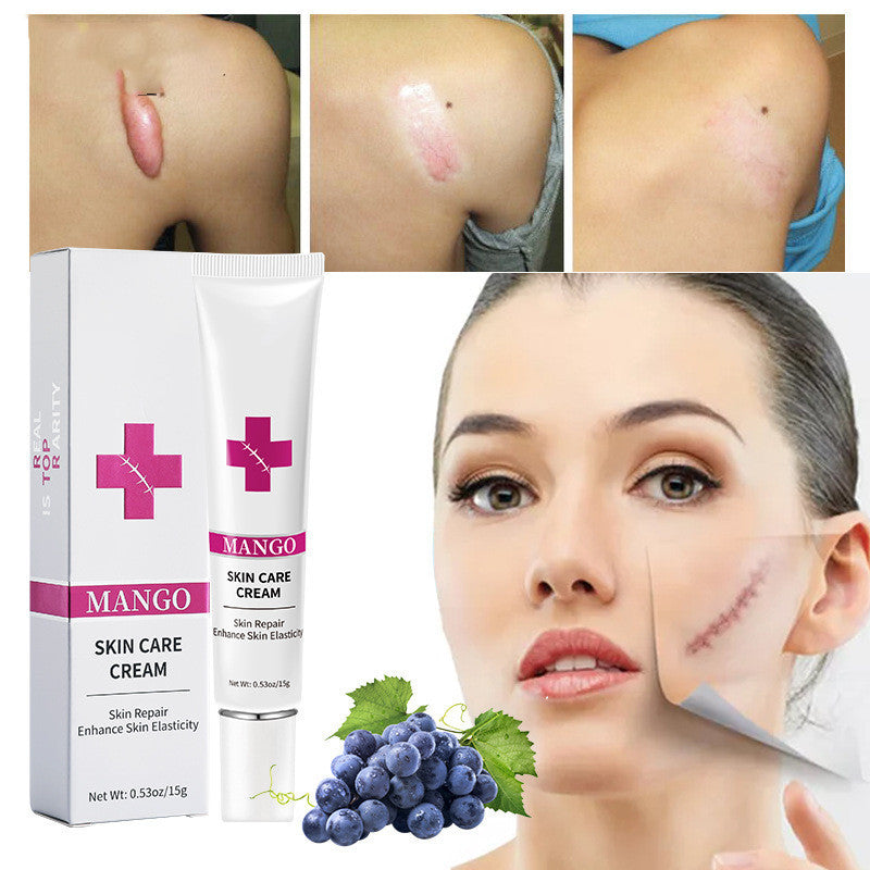 Scar Removal Cream For Men And Women