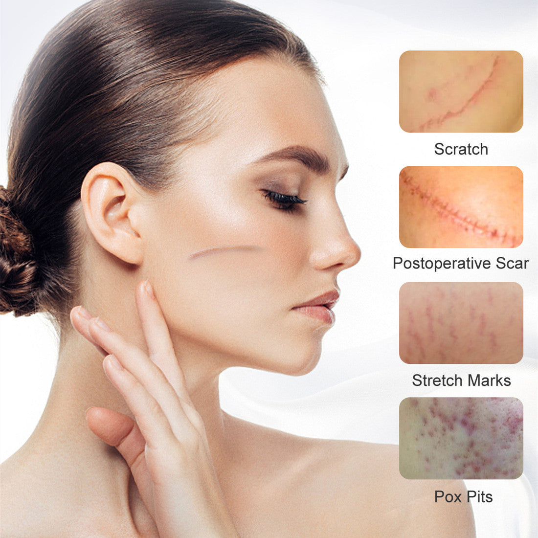 Scar Removal Cream For Men And Women