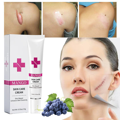 Scar Removal Cream For Men And Women